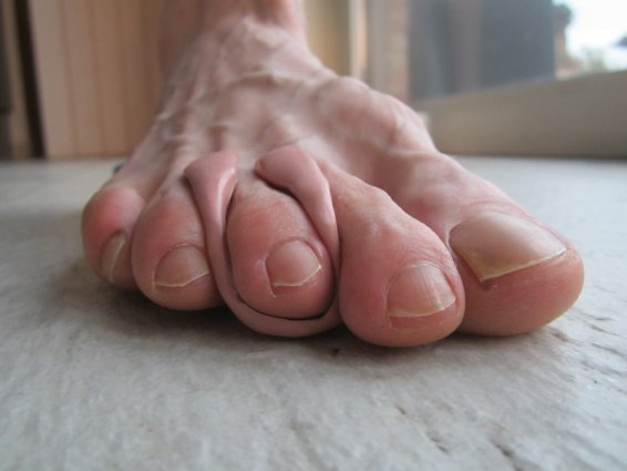 silicone 2